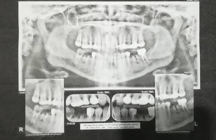 تخلفات محرز مراکز رادیولوژی دندانپزشکی و نبود نظارت در رفسنجان